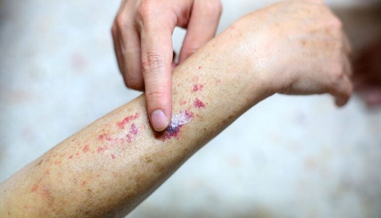 Hoy 22 de septiembre: Día Mundial de la Leucemia
