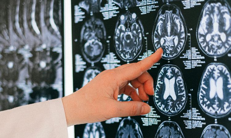 Hoy 26 de octubre: Día Mundial del Daño Cerebral